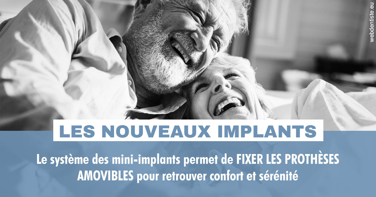 https://selarl-edanael.chirurgiens-dentistes.fr/Les nouveaux implants 2