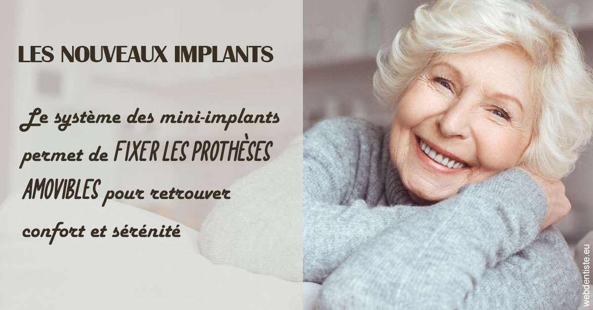 https://selarl-edanael.chirurgiens-dentistes.fr/Les nouveaux implants 1