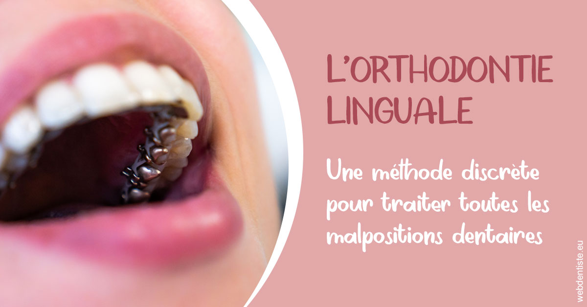 https://selarl-edanael.chirurgiens-dentistes.fr/L'orthodontie linguale 2