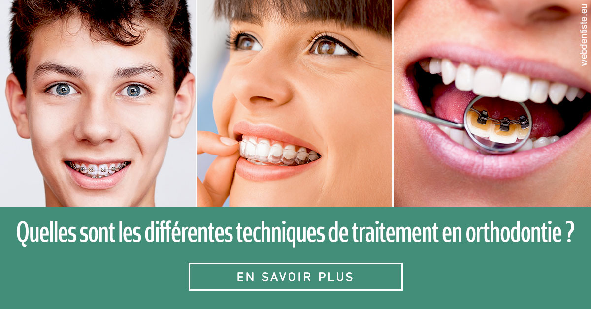 https://selarl-edanael.chirurgiens-dentistes.fr/Les différentes techniques de traitement 2