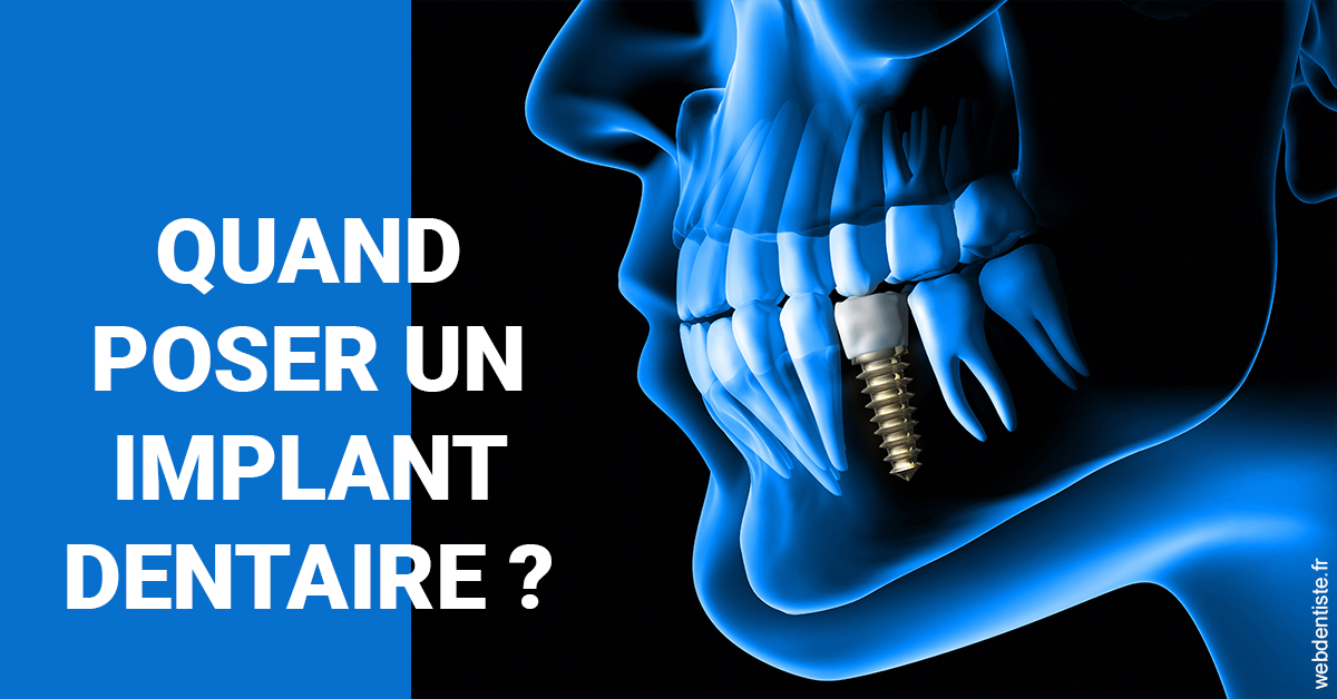 https://selarl-edanael.chirurgiens-dentistes.fr/Les implants 1
