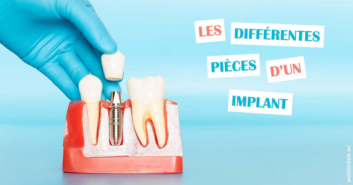 https://selarl-edanael.chirurgiens-dentistes.fr/Les différentes pièces d’un implant 2
