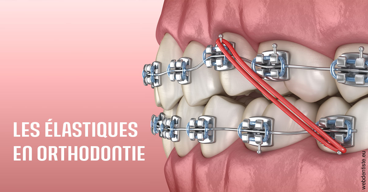 https://selarl-edanael.chirurgiens-dentistes.fr/Elastiques orthodontie 2