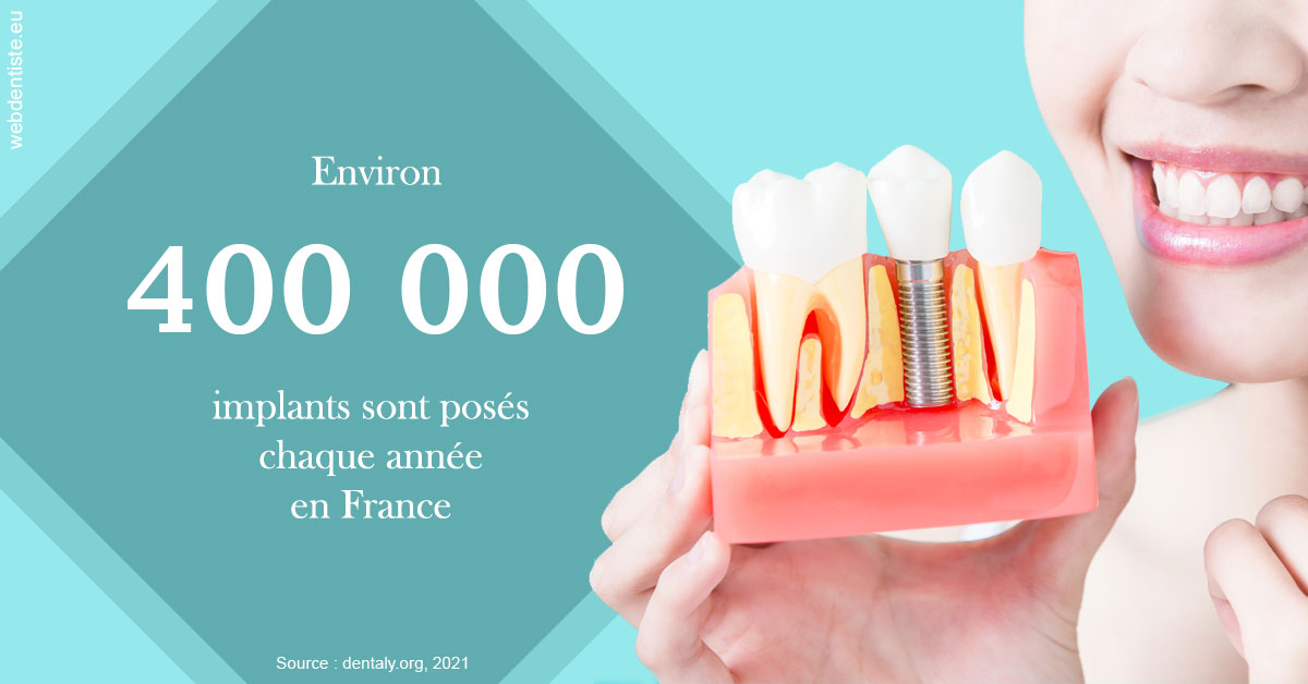 https://selarl-edanael.chirurgiens-dentistes.fr/Pose d'implants en France 2